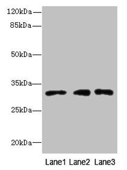 Western blot. All lanes: PRDX4 antibody at 8µg/ml. Lane 1: HepG2 whole cell lysate. Lane 2: Hela whole cell lysate. Lane 3: 293T whole cell lysate. Secondary. Goat polyclonal to rabbit IgG at 1/10000 dilution. Predicted band size: 31 kDa. Observed band size: 31 kDa