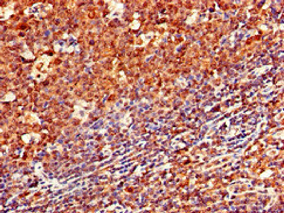 Immunohistochemistry of paraffin-embedded human tonsil tissue using CSB-PA004957LA01HU at dilution of 1:100