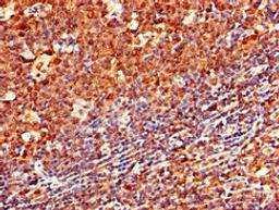 Immunohistochemistry of paraffin-embedded human tonsil tissue using CSB-PA004957LA01HU at dilution of 1:100