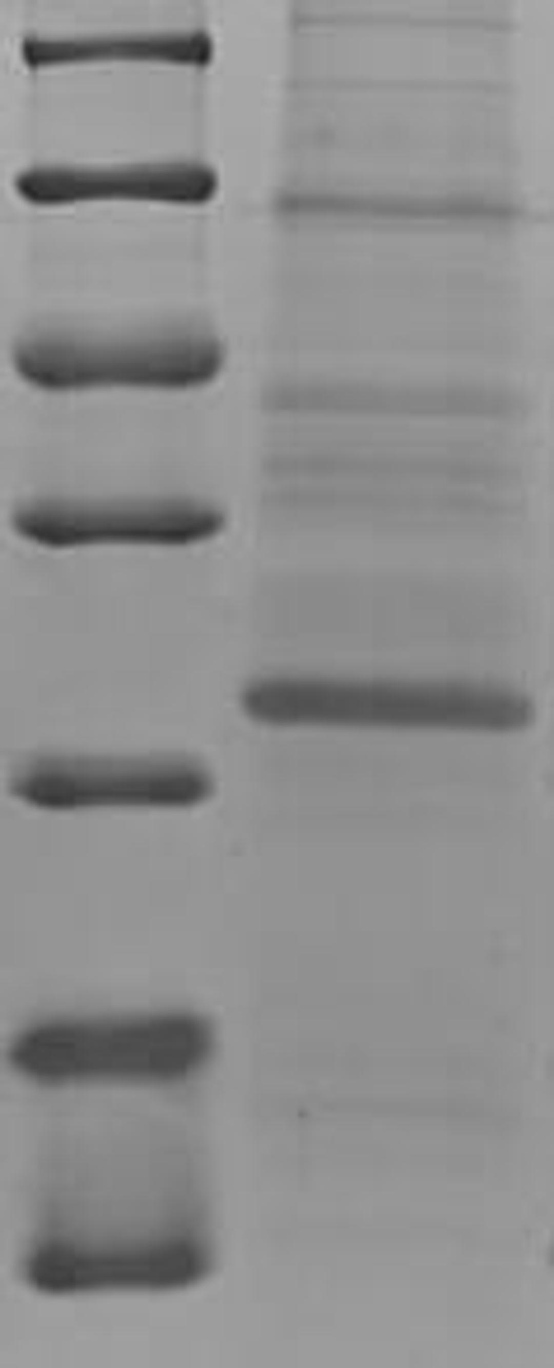 (Tris-Glycine gel) Discontinuous SDS-PAGE (reduced) with 5% enrichment gel and 15% separation gel.