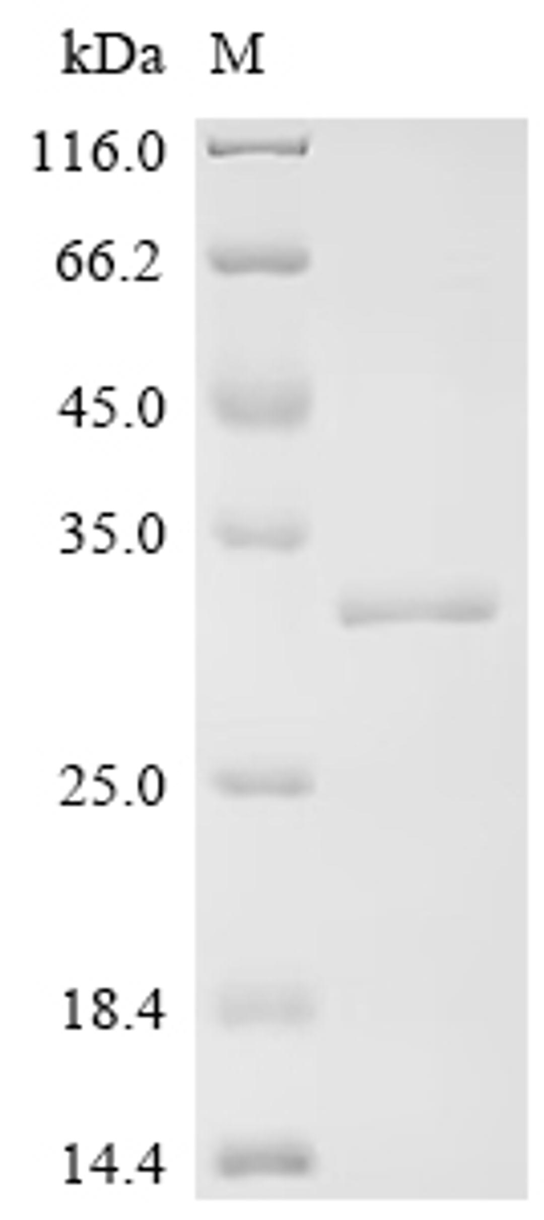 (Tris-Glycine gel) Discontinuous SDS-PAGE (reduced) with 5% enrichment gel and 15% separation gel.
