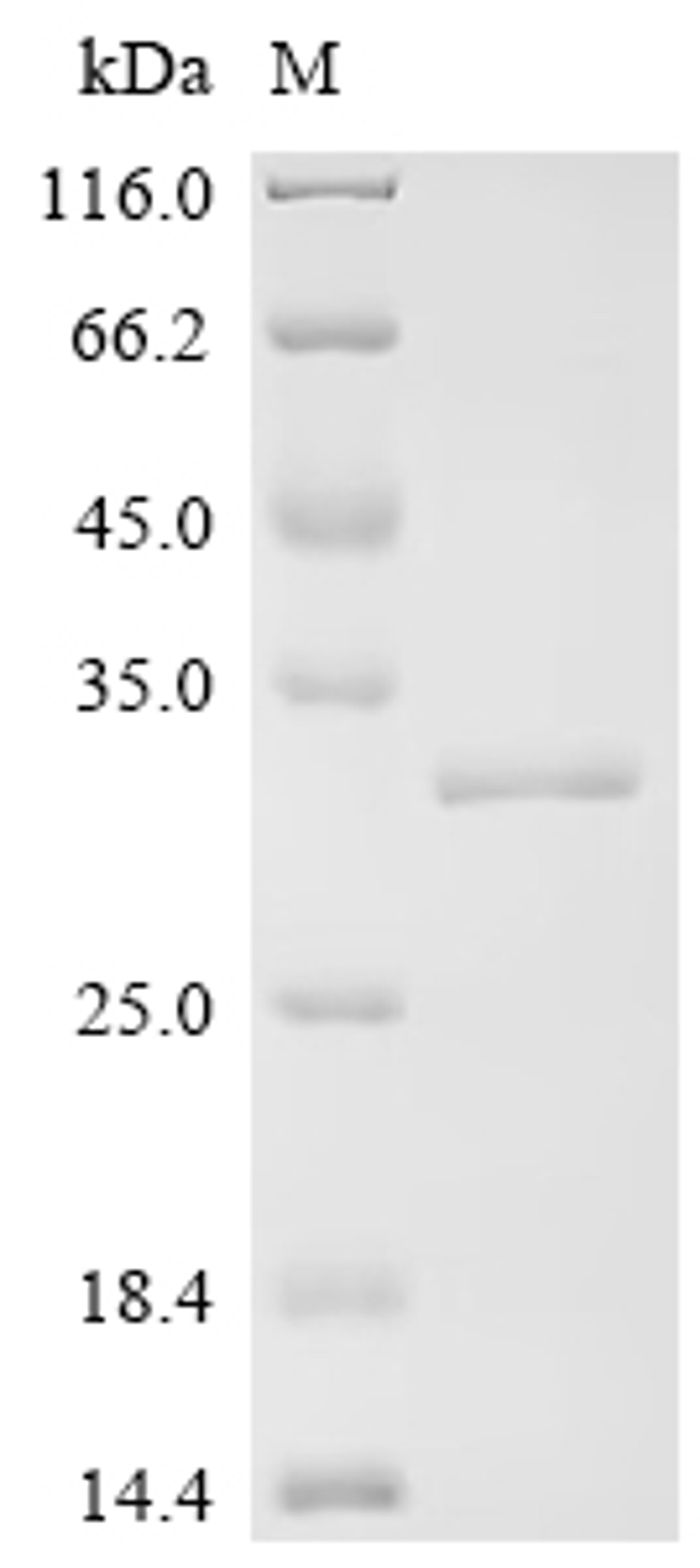 (Tris-Glycine gel) Discontinuous SDS-PAGE (reduced) with 5% enrichment gel and 15% separation gel.