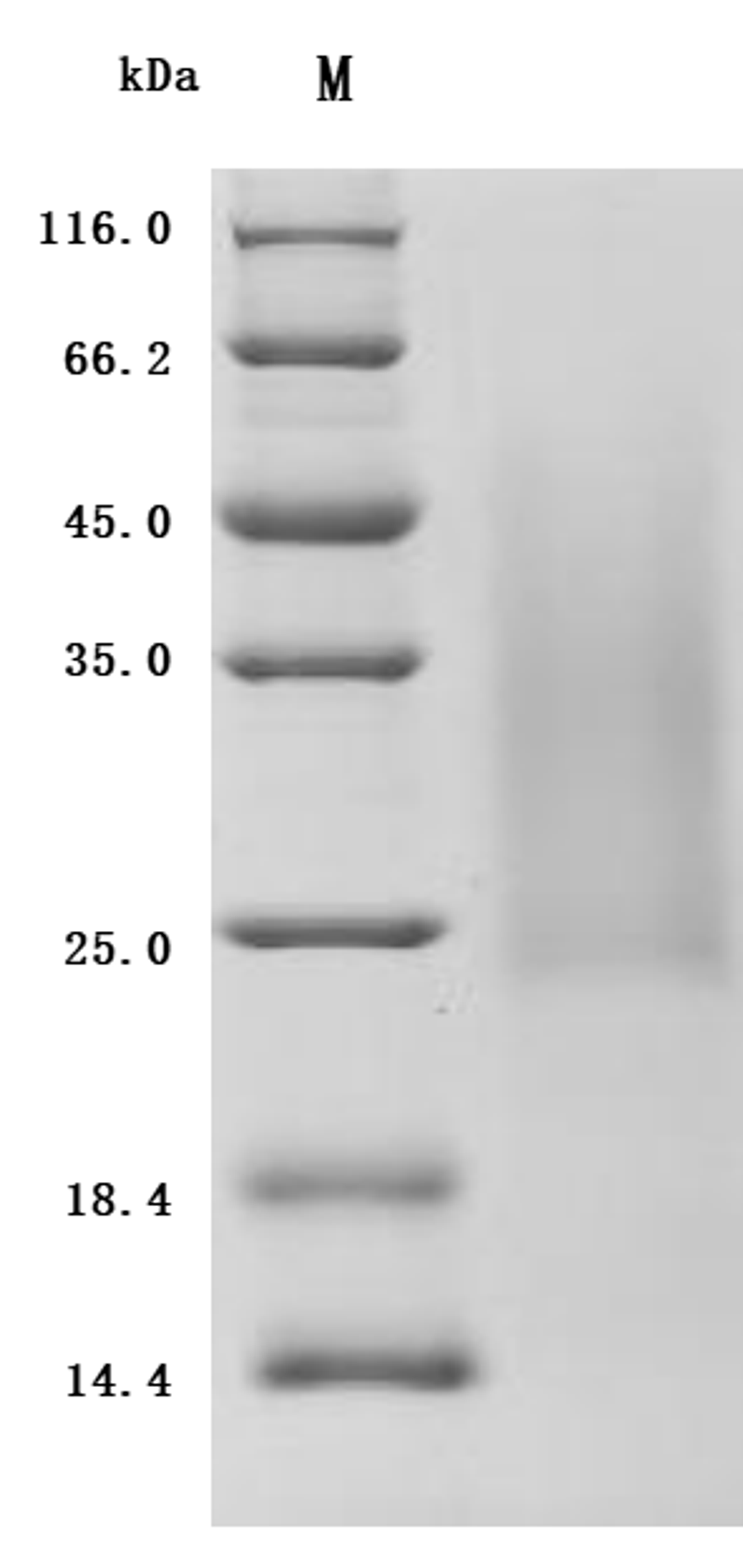 (Tris-Glycine gel) Discontinuous SDS-PAGE (reduced) with 5% enrichment gel and 15% separation gel.