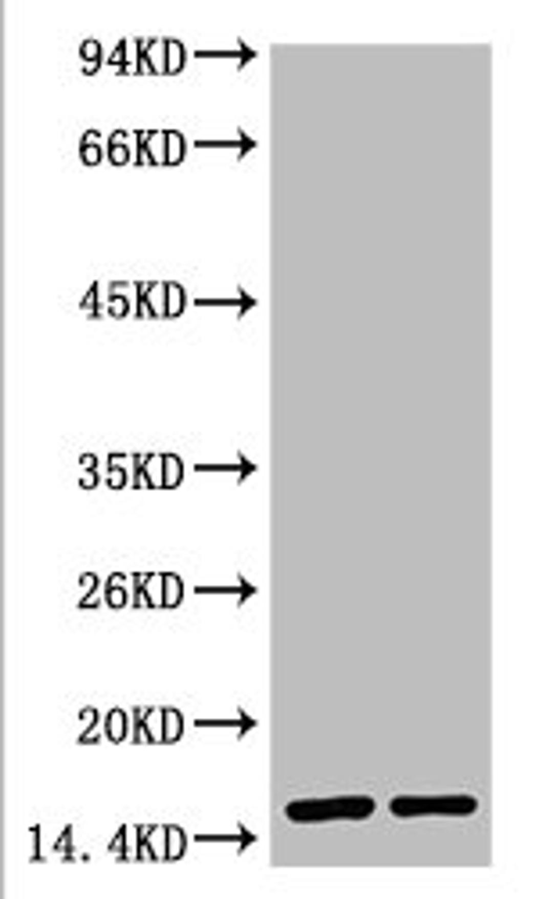 Western blot analysis of Hela, diluted at 1) 1:2000 2) 1:5000
