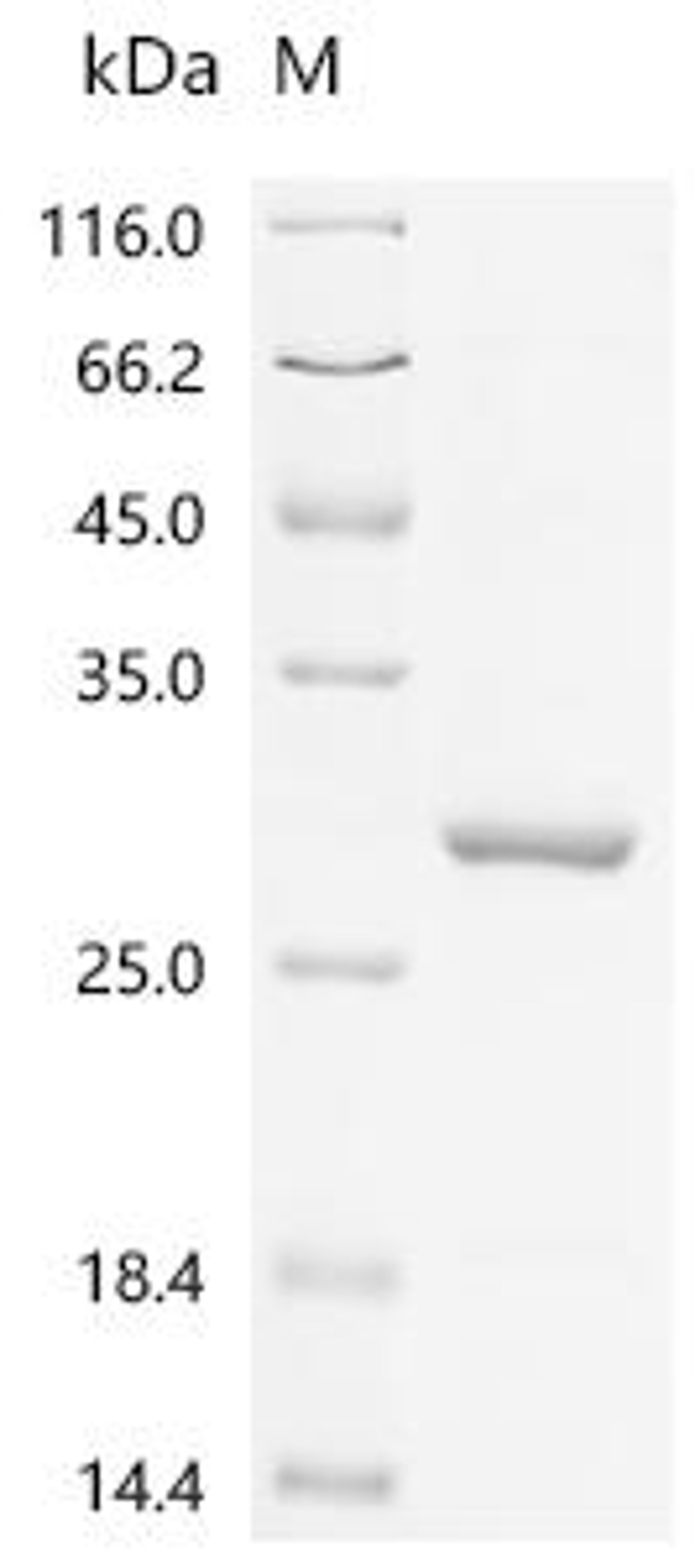 (Tris-Glycine gel) Discontinuous SDS-PAGE (reduced) with 5% enrichment gel and 15% separation gel.