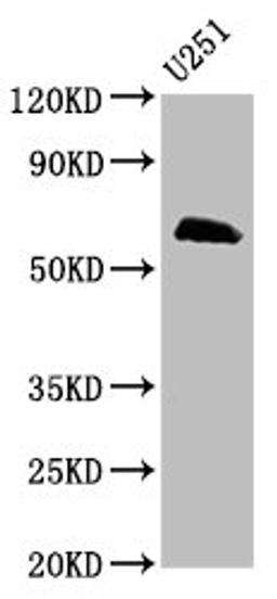 Western Blot. Positive WB detected in: U251 whole cell lysate. All lanes: MSL2 antibody at 5µg/ml. Secondary. Goat polyclonal to rabbit IgG at 1/50000 dilution. Predicted band size: 63, 55 kDa. Observed band size: 63 kDa