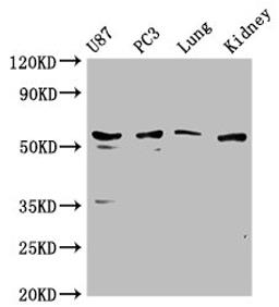 Western Blot. Positive WB detected in: U87 whole cell lysate, PC3 whole cell lysate, Mouse lung tissue, Mouse kidney tissue. All lanes: PPP5C antibody at 1:1000. Secondary. Goat polyclonal to rabbit IgG at 1/50000 dilution. Predicted band size: 57 kDa. Observed band size: 57 kDa. 