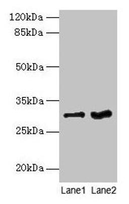 Western blot. All lanes: FGFR1OP2 antibody at 6µg/ml. Lane 1: Mouse gonadal tissue. Lane 2: Human placenta tissue. Secondary. Goat polyclonal to rabbit IgG at 1/10000 dilution. Predicted band size: 30, 25, 21 kDa. Observed band size: 30 kDa