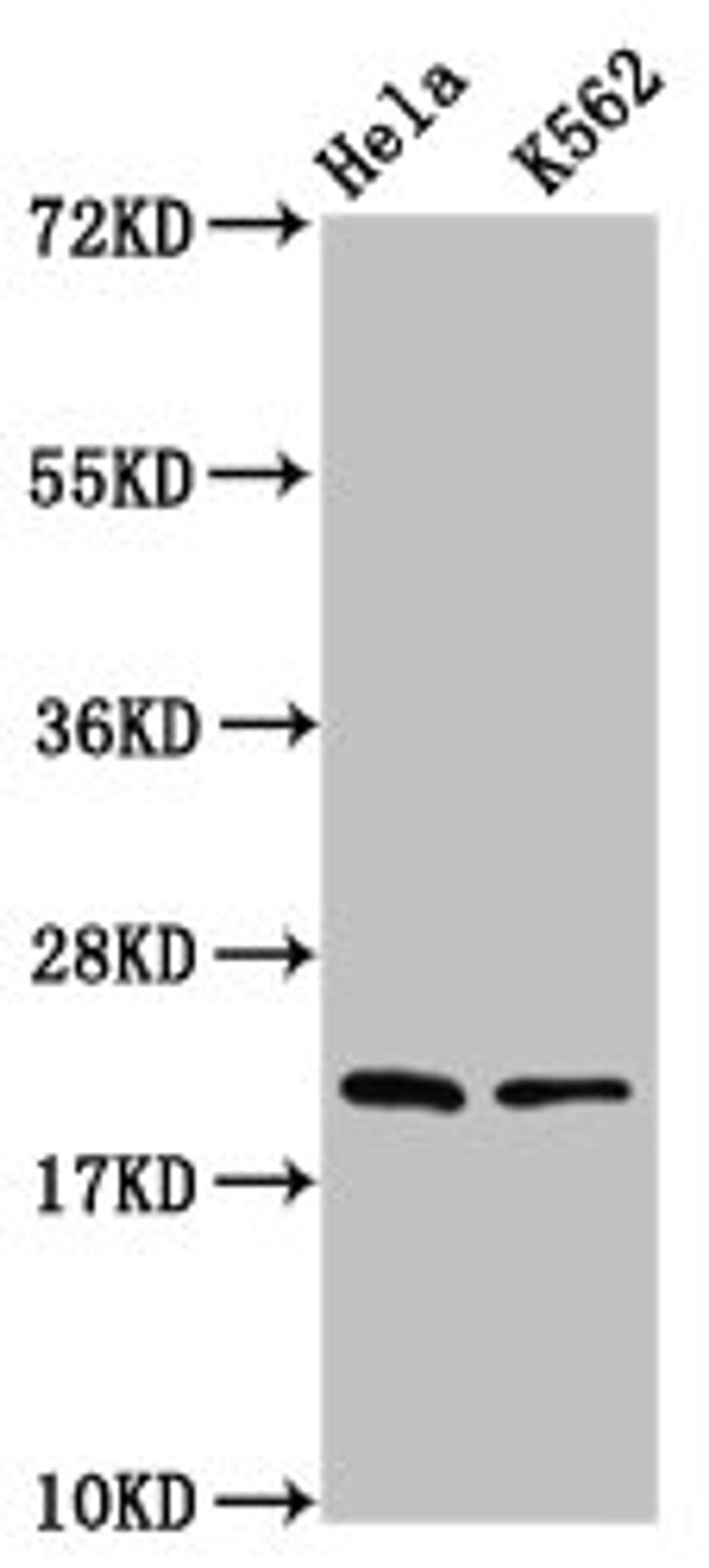 Western Blot. Positive WB detected in: Hela whole cell lysate, K562 whole cell lysate. All lanes: HIST1H1D antibody at 1.25µg/ml. Secondary. Goat polyclonal to rabbit IgG at 1/50000 dilution. Predicted band size: 23 kDa. Observed band size: 23 kDa