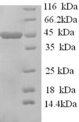 (Tris-Glycine gel) Discontinuous SDS-PAGE (reduced) with 5% enrichment gel and 15% separation gel.