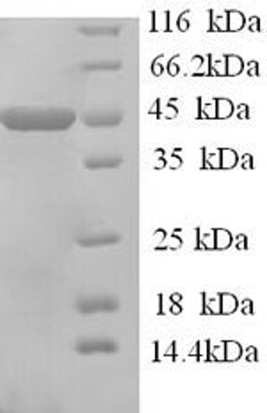 (Tris-Glycine gel) Discontinuous SDS-PAGE (reduced) with 5% enrichment gel and 15% separation gel.