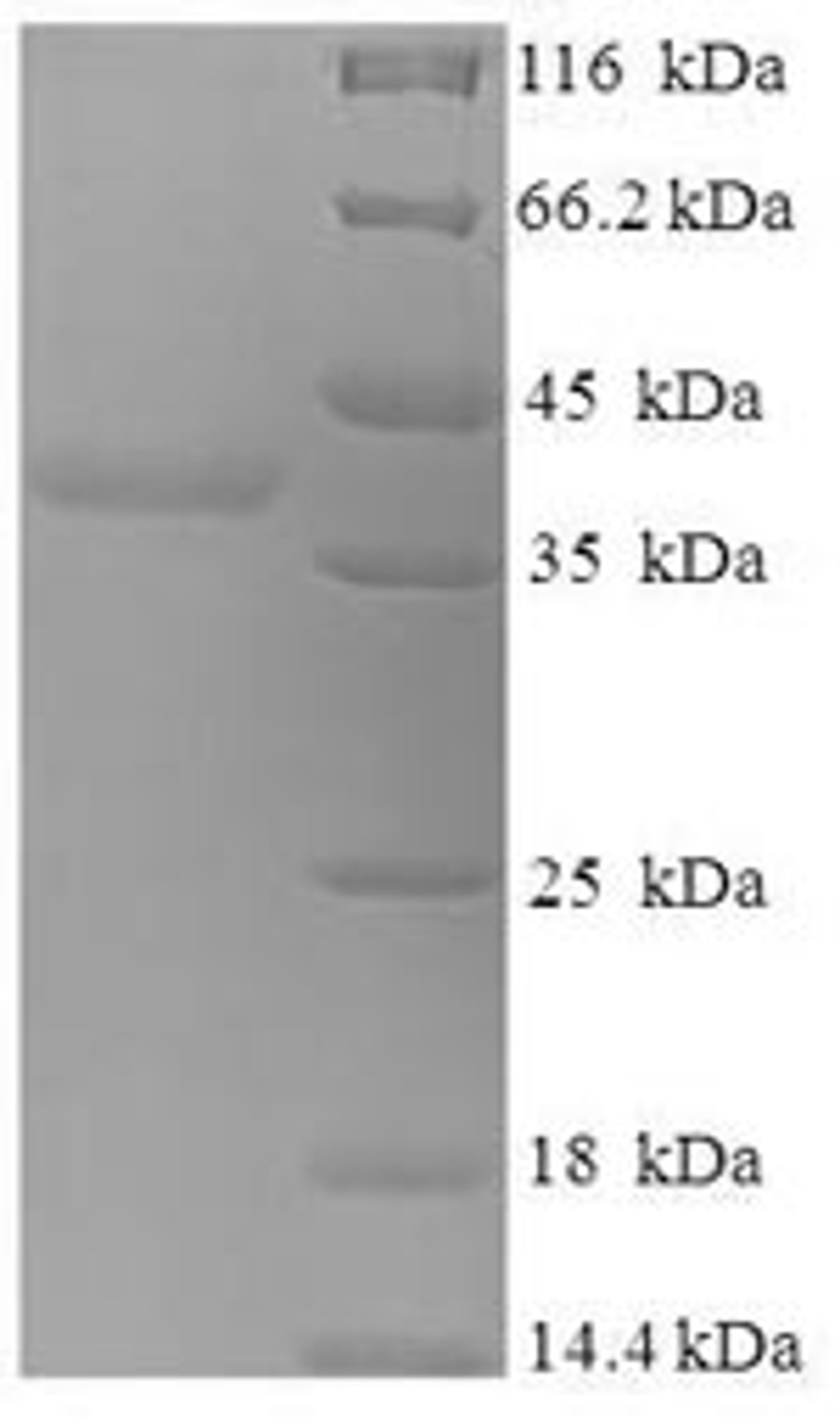 (Tris-Glycine gel) Discontinuous SDS-PAGE (reduced) with 5% enrichment gel and 15% separation gel.