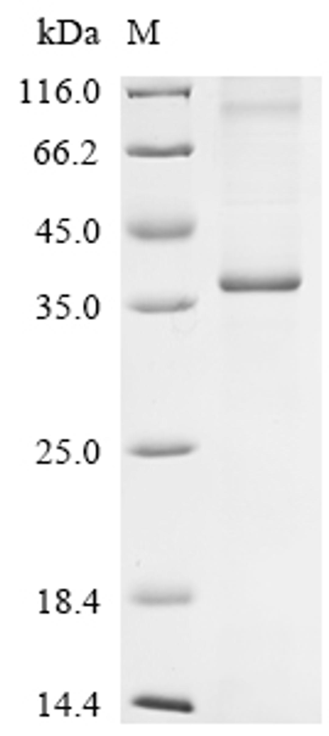 (Tris-Glycine gel) Discontinuous SDS-PAGE (reduced) with 5% enrichment gel and 15% separation gel.