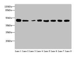 Western blot. All lanes: ACTL6A antibody at 4 ug/ml. Lane 1: Mouse thymus tissue. Lane 2: Mouse spleen tissue. Lane 3: Mouse heart tissue. Lane 4: Jurkats whole cell lysate. Lane 5: K562 whole cell lysate. Lane 6: Hela whole cell lysate. Lane 7: A549 whole cell lysate. Lane 8: MCF-7 whole cell lysate. Secondary. Goat polyclonal to rabbit IgG at 1/10000 dilution. Predicted band size: 48, 44 kDa. Observed band size: 48 kDa. 