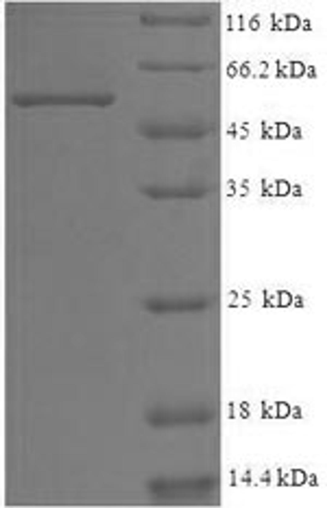 (Tris-Glycine gel) Discontinuous SDS-PAGE (reduced) with 5% enrichment gel and 15% separation gel.