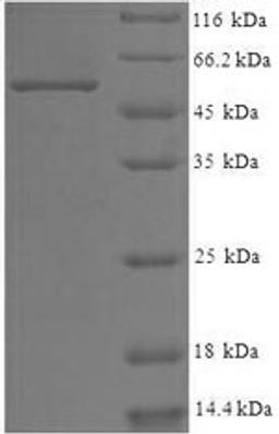 (Tris-Glycine gel) Discontinuous SDS-PAGE (reduced) with 5% enrichment gel and 15% separation gel.