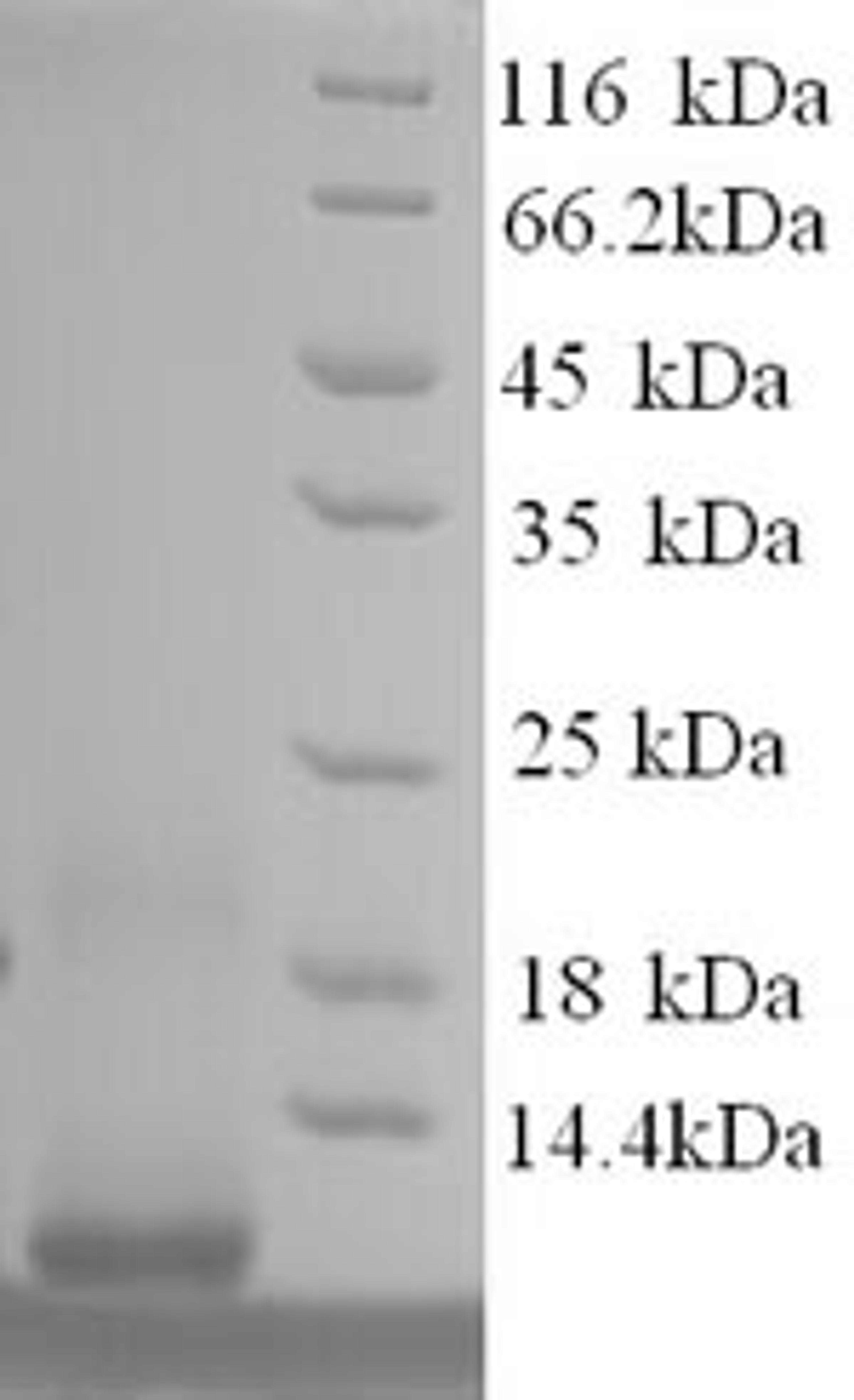 (Tris-Glycine gel) Discontinuous SDS-PAGE (reduced) with 5% enrichment gel and 15% separation gel.