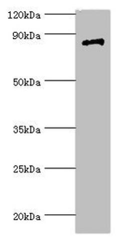 Western blot. All lanes: Signal transducer and activator of transcription 4 antibody at 7ug/ml + Jurkat whole cell lysate. Secondary. Goat polyclonal to rabbit IgG at 1/10000 dilution. Predicted band size: 86 kDa. Observed band size: 86 kDa. 