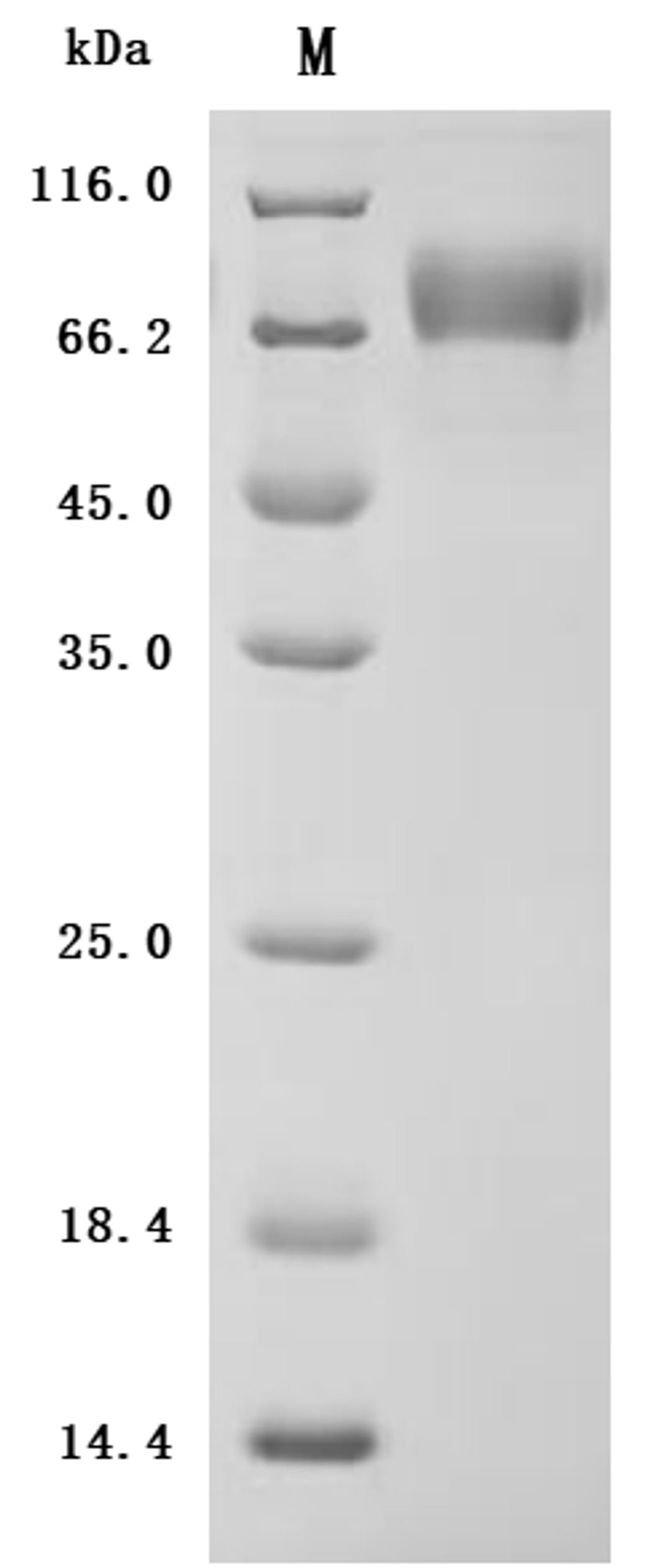 (Tris-Glycine gel) Discontinuous SDS-PAGE (reduced) with 5% enrichment gel and 15% separation gel.