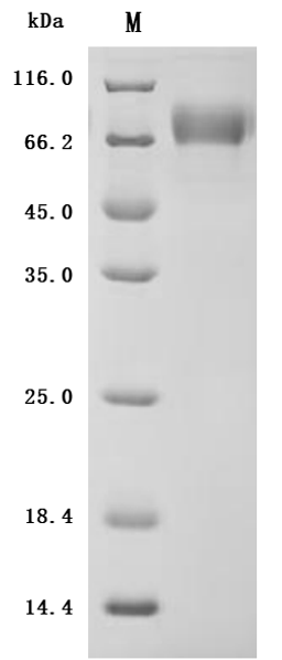 (Tris-Glycine gel) Discontinuous SDS-PAGE (reduced) with 5% enrichment gel and 15% separation gel.