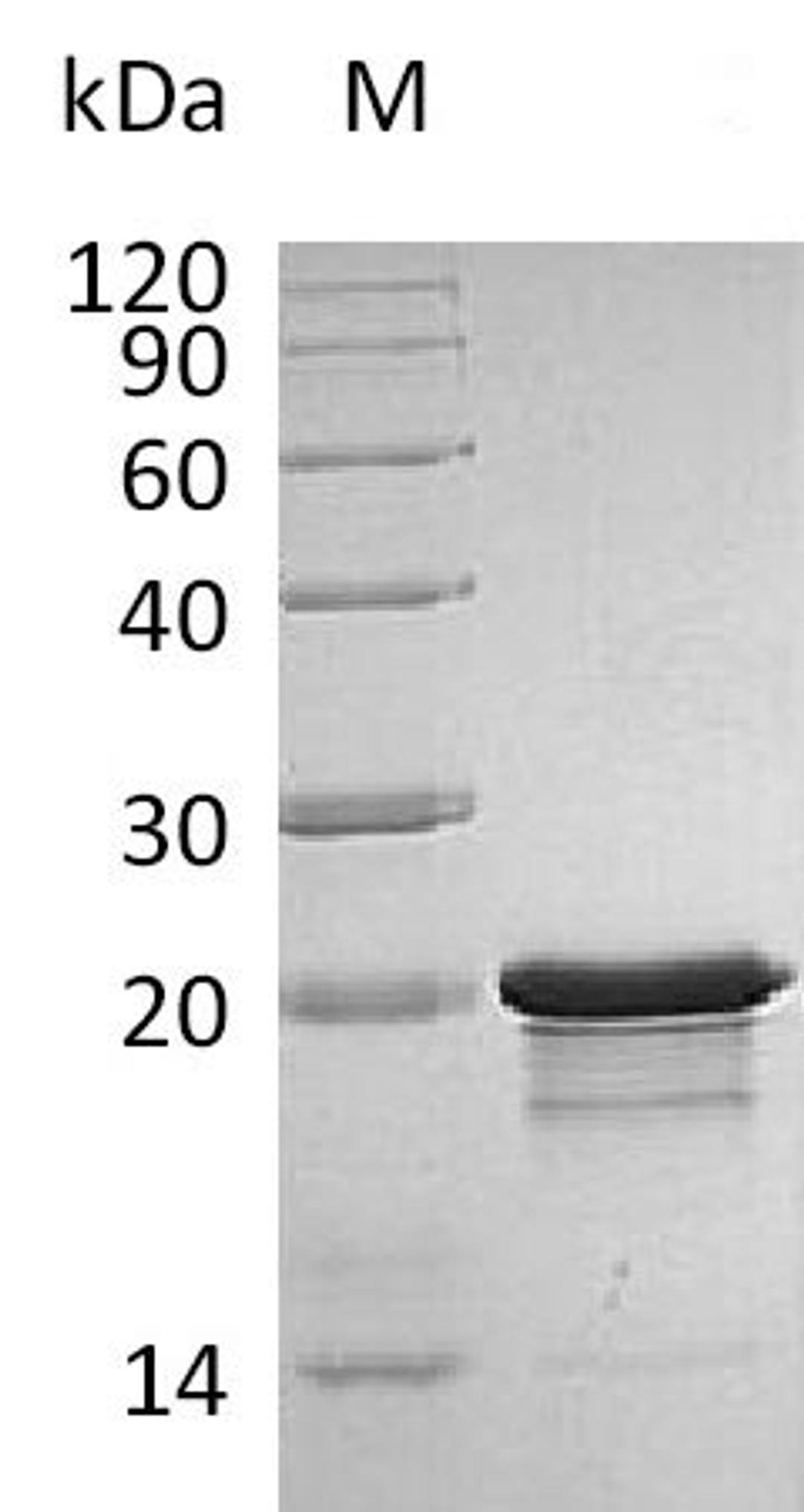 (Tris-Glycine gel) Discontinuous SDS-PAGE (reduced) with 5% enrichment gel and 15% separation gel.