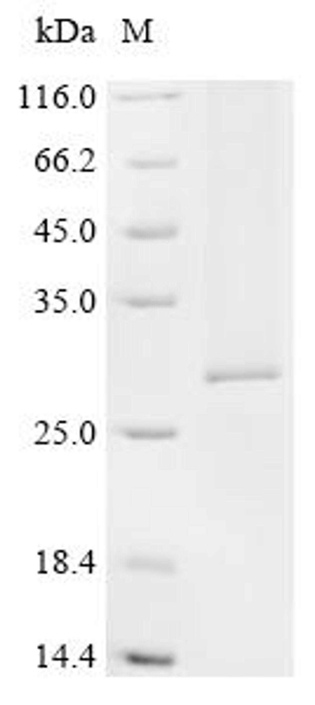 (Tris-Glycine gel) Discontinuous SDS-PAGE (reduced) with 5% enrichment gel and 15% separation gel.