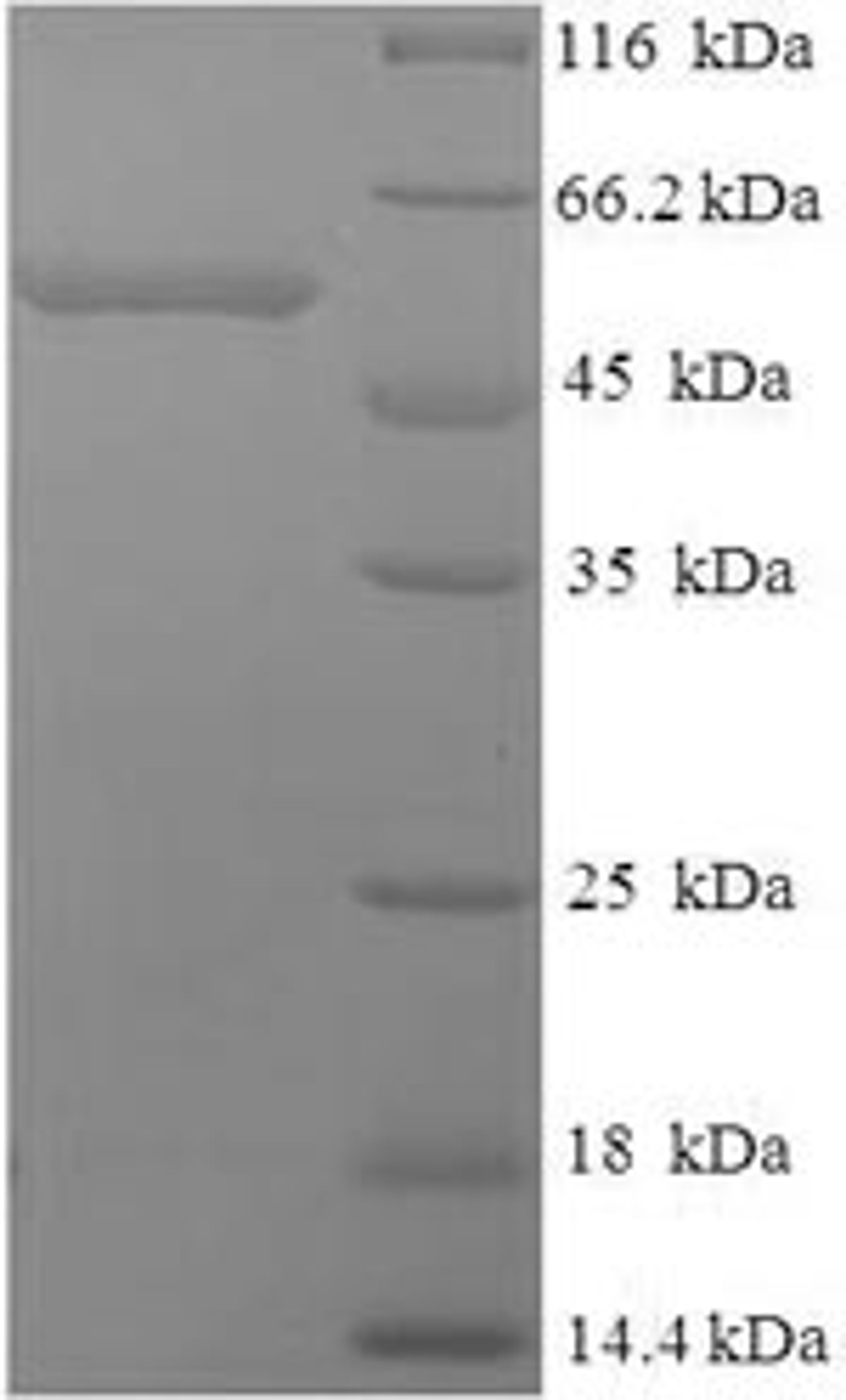 (Tris-Glycine gel) Discontinuous SDS-PAGE (reduced) with 5% enrichment gel and 15% separation gel.