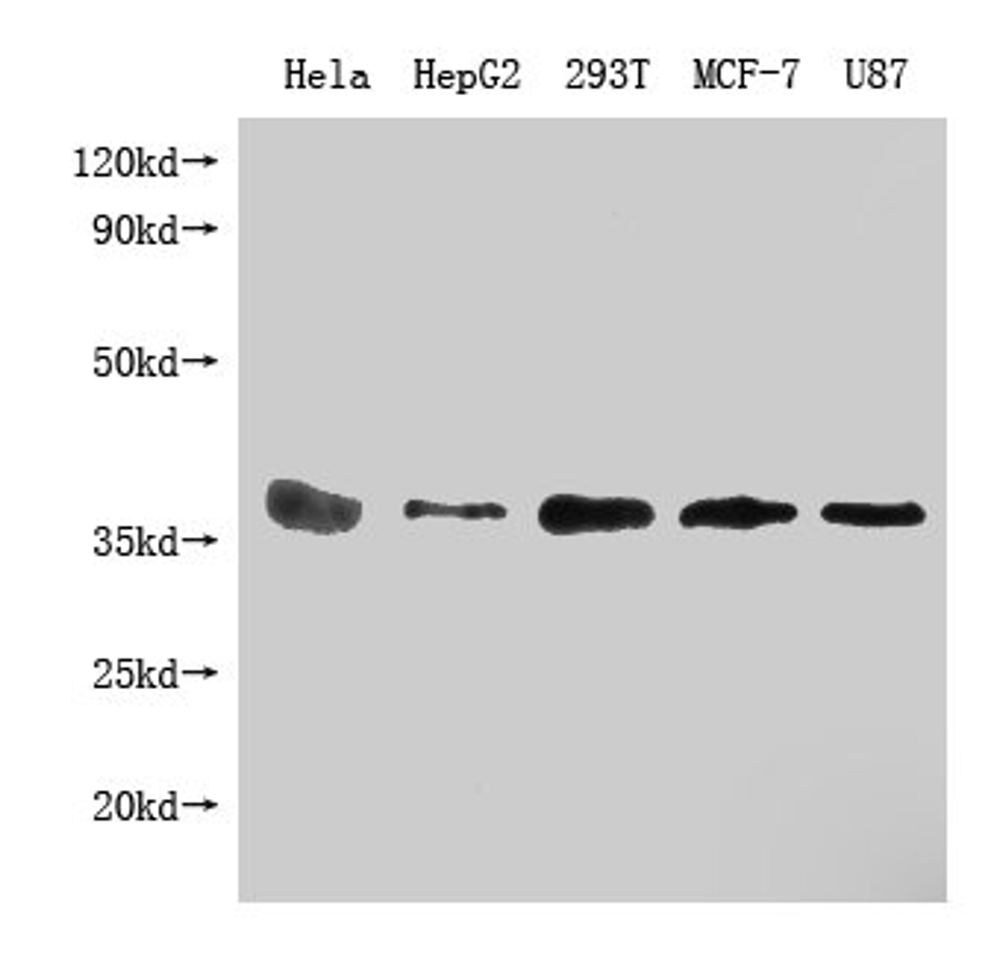 Western Blot.  Positive WB detected in: PPA1 antibody at 1:1000.  Lane 1: Hela whole cell lysate.  Lane 2: HepG2 whole cell lysate.  Lane 3: 293T whole cell lysate.  Lane 4: MCF-7 whole cell lysate.  Lane 5: U87 whole cell lysate. Secondary.  Goat polyclonal to Mouse IgG at 1/20000 dilution.  Predicted band size: 33KDa.  Observed band size: 33 KDa.  Exposure time: 5min