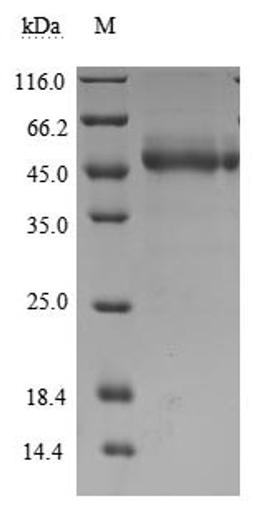 (Tris-Glycine gel) Discontinuous SDS-PAGE (reduced) with 5% enrichment gel and 15% separation gel.