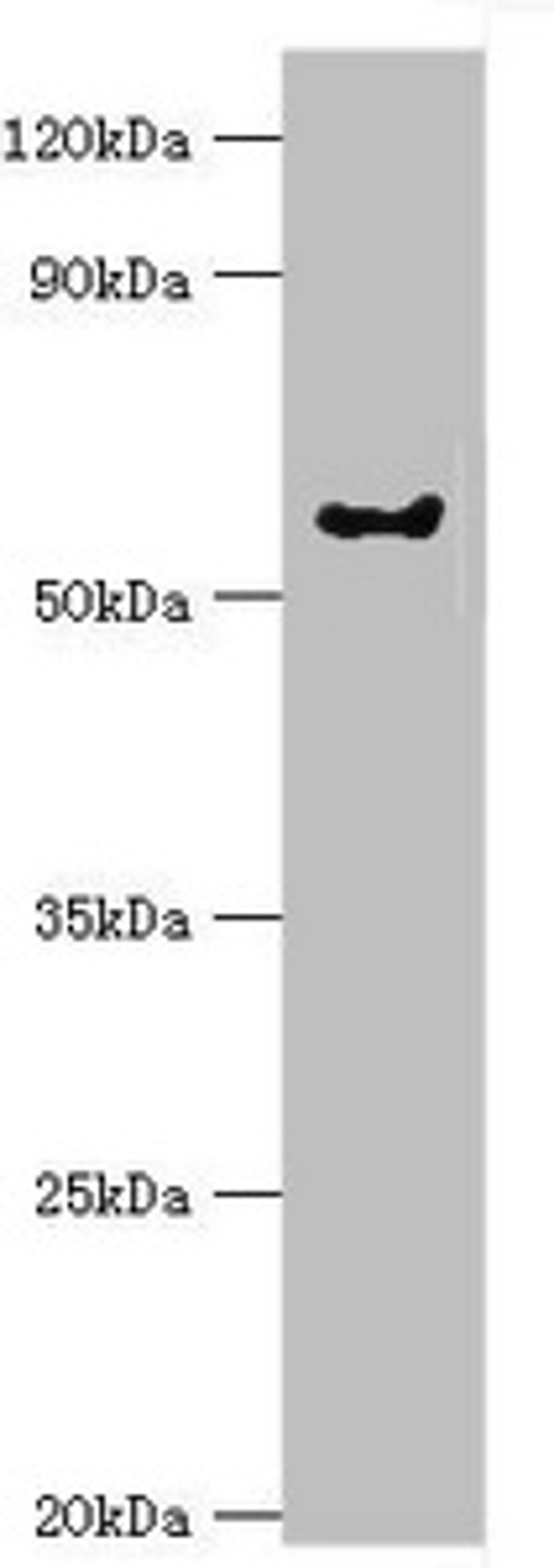 Western blot. All lanes: G protein-coupled receptor kinase 6 antibody at 6ug/ml + Rat heart tissue. Secondary. Goat polyclonal to rabbit IgG at 1/10000 dilution. Predicted band size: 66, 68, 65 kDa. Observed band size: 66 kDa. 