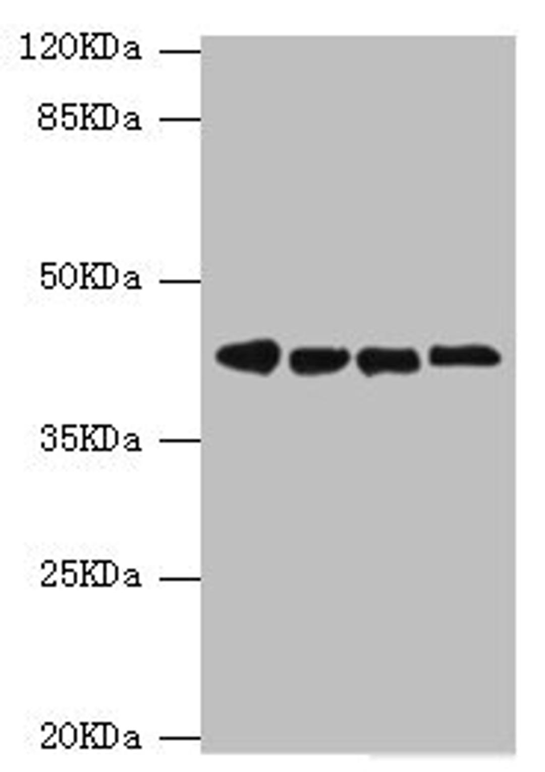 Western blot. All lanes: DNAJA2 antibody at 3.79ug/ml. Lane 1: A375 whole cell lysate. Lane 2: PC-3 whole cell lysate. Lane 3: HepG2 whole cell lysate. Lane 4: Hela whole cell lysate. Secondary. Goat polyclonal to rabbit IgG at 1/10000 dilution. Predicted band size: 46 kDa. Observed band size: 46 kDa. 
