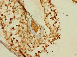Immunohistochemistry of paraffin-embedded human testis tissue using CSB-PA883629LA01HU at dilution of 1:100