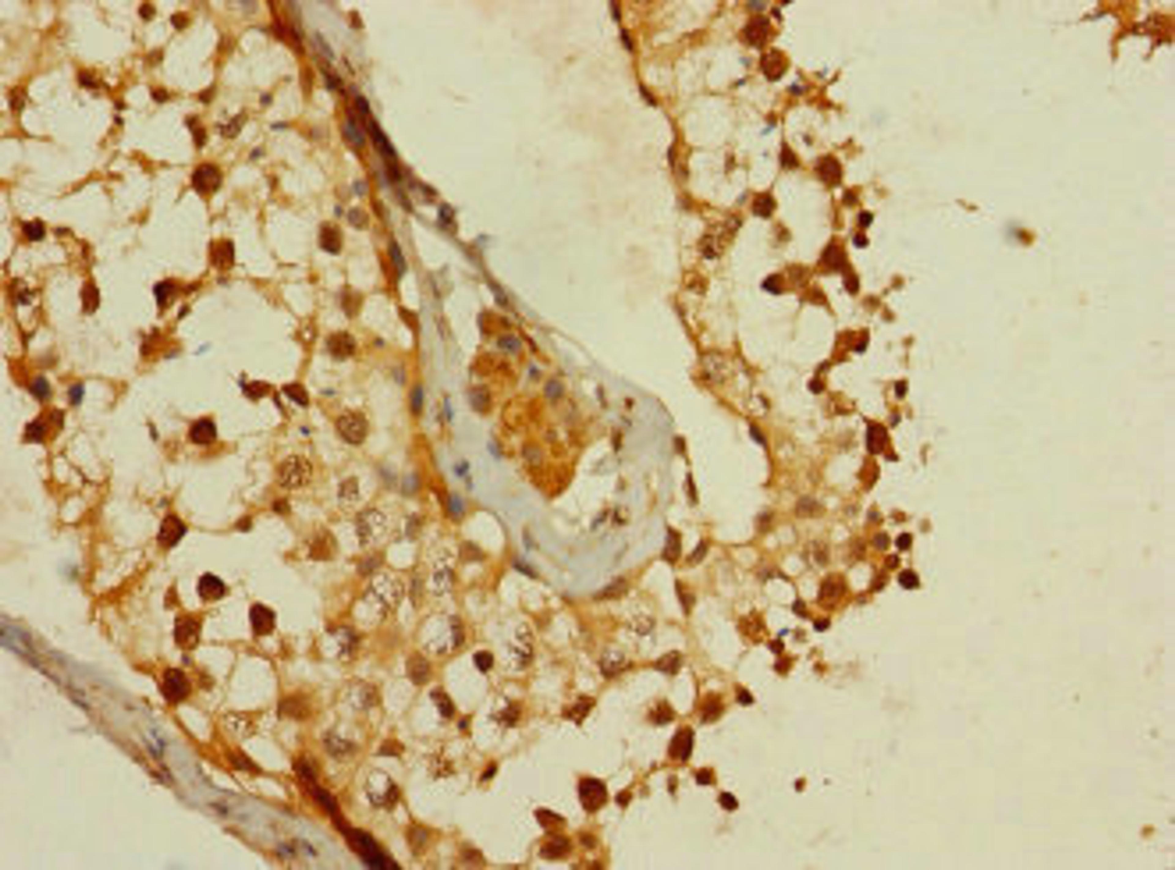 Immunohistochemistry of paraffin-embedded human testis tissue using CSB-PA883629LA01HU at dilution of 1:100