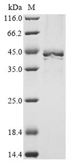 (Tris-Glycine gel) Discontinuous SDS-PAGE (reduced) with 5% enrichment gel and 15% separation gel.
