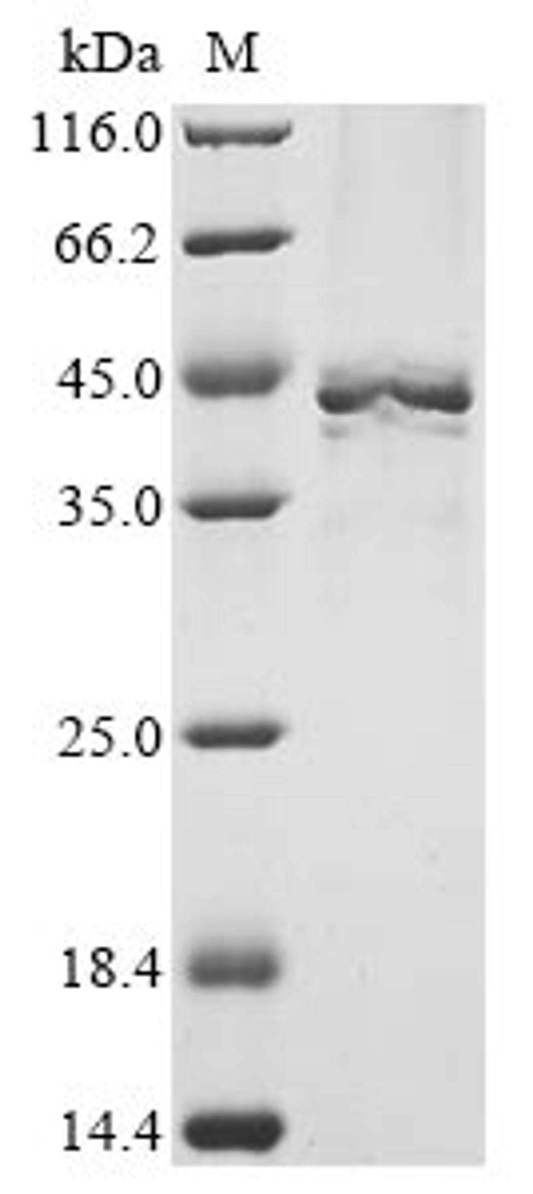 (Tris-Glycine gel) Discontinuous SDS-PAGE (reduced) with 5% enrichment gel and 15% separation gel.