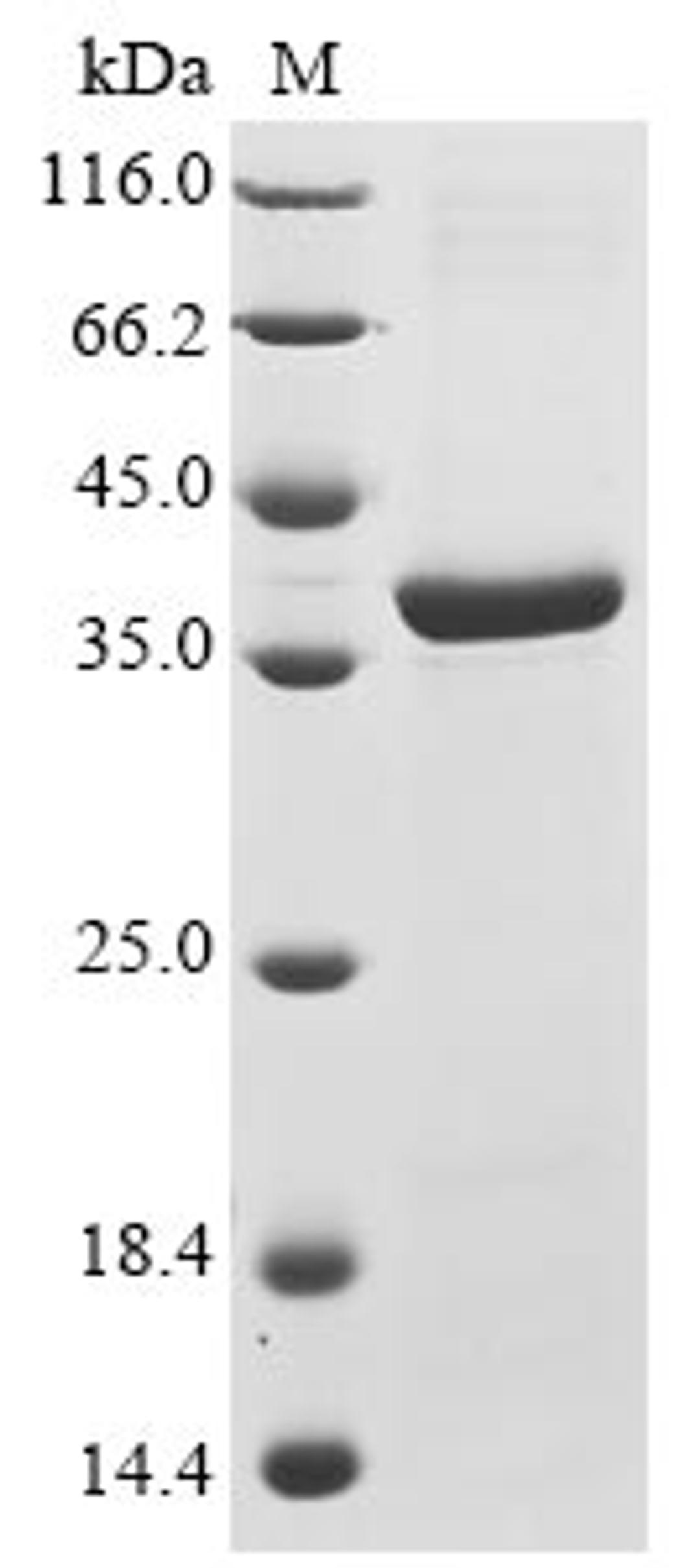 (Tris-Glycine gel) Discontinuous SDS-PAGE (reduced) with 5% enrichment gel and 15% separation gel.