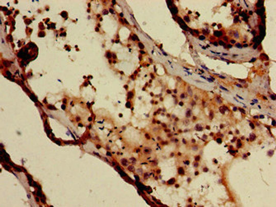 Immunohistochemistry of paraffin-embedded human testis tissue using CSB-PA007116LA01HU at dilution of 1:100