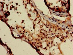Immunohistochemistry of paraffin-embedded human testis tissue using CSB-PA007116LA01HU at dilution of 1:100