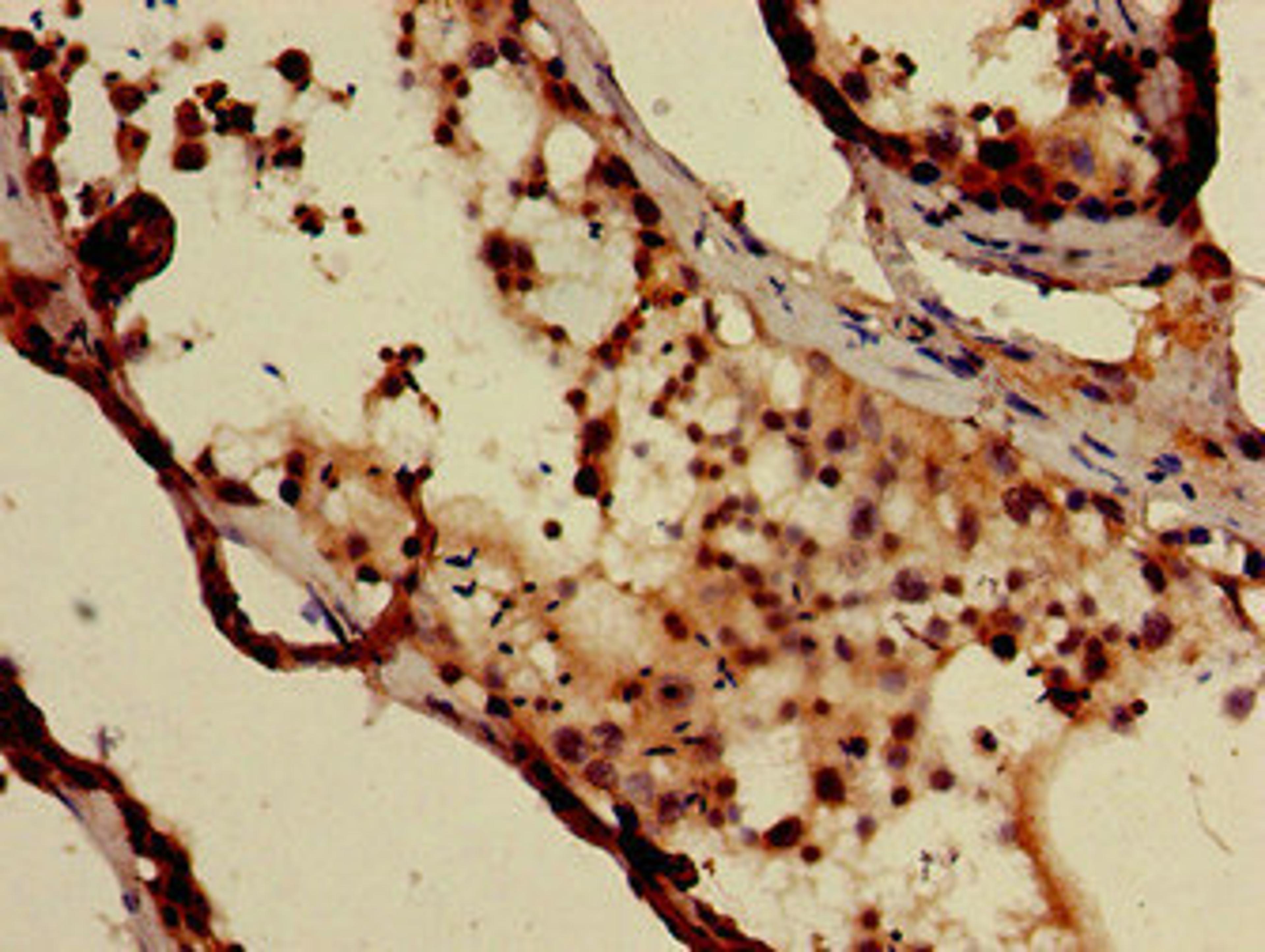 Immunohistochemistry of paraffin-embedded human testis tissue using CSB-PA007116LA01HU at dilution of 1:100