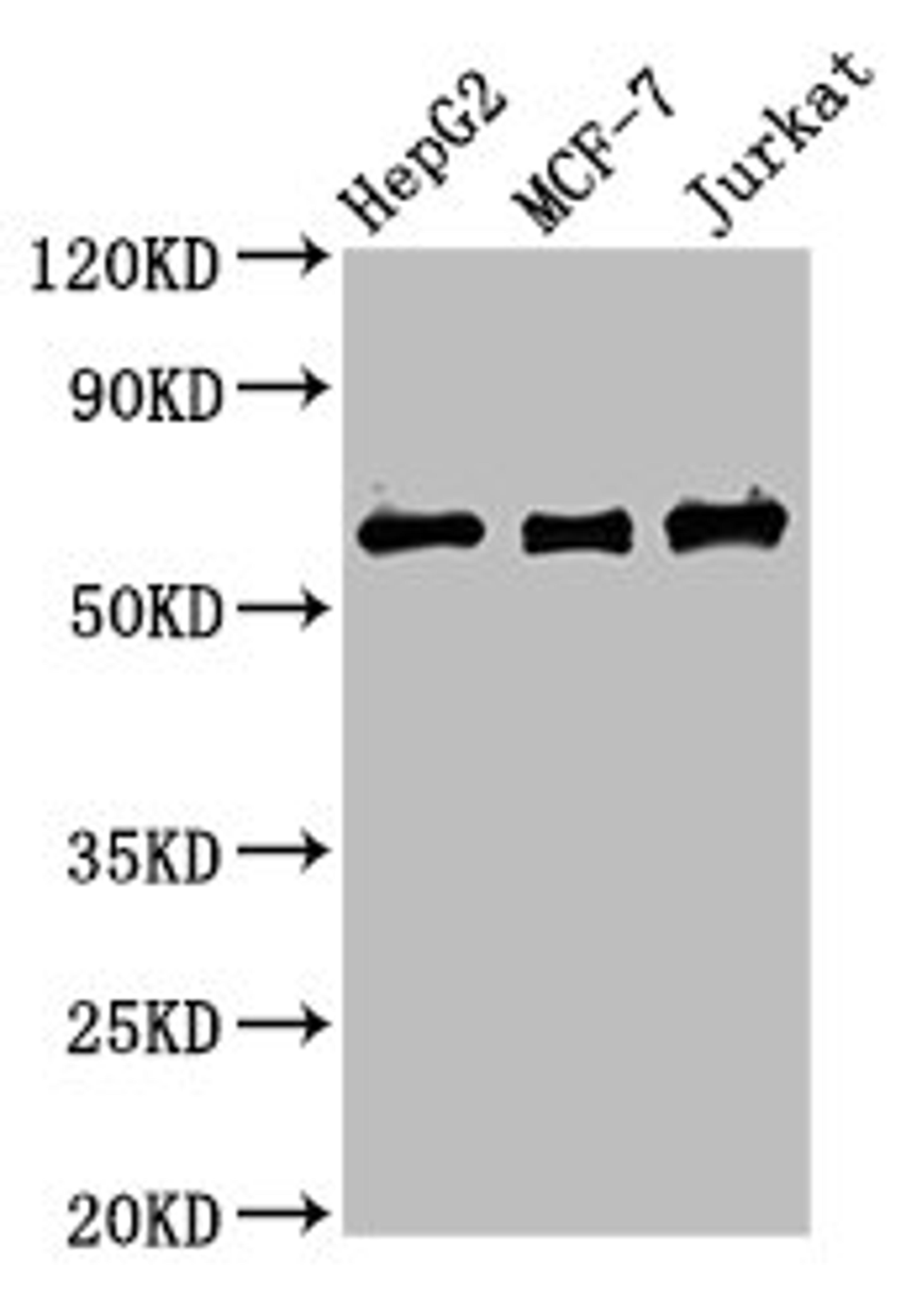 Western Blot. Positive WB detected in: HepG2 whole cell lysate, MCF-7 whole cell lysate, Jurkat whole cell lysate. All lanes: PRUNE1 antibody at 4µg/ml. Secondary. Goat polyclonal to rabbit IgG at 1/50000 dilution. Predicted band size: 51, 43, 31, 27, 25, 19 kDa. Observed band size: 60 kDa
