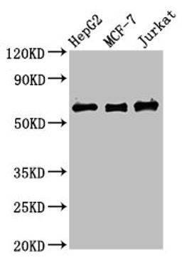 Western Blot. Positive WB detected in: HepG2 whole cell lysate, MCF-7 whole cell lysate, Jurkat whole cell lysate. All lanes: PRUNE1 antibody at 4µg/ml. Secondary. Goat polyclonal to rabbit IgG at 1/50000 dilution. Predicted band size: 51, 43, 31, 27, 25, 19 kDa. Observed band size: 60 kDa