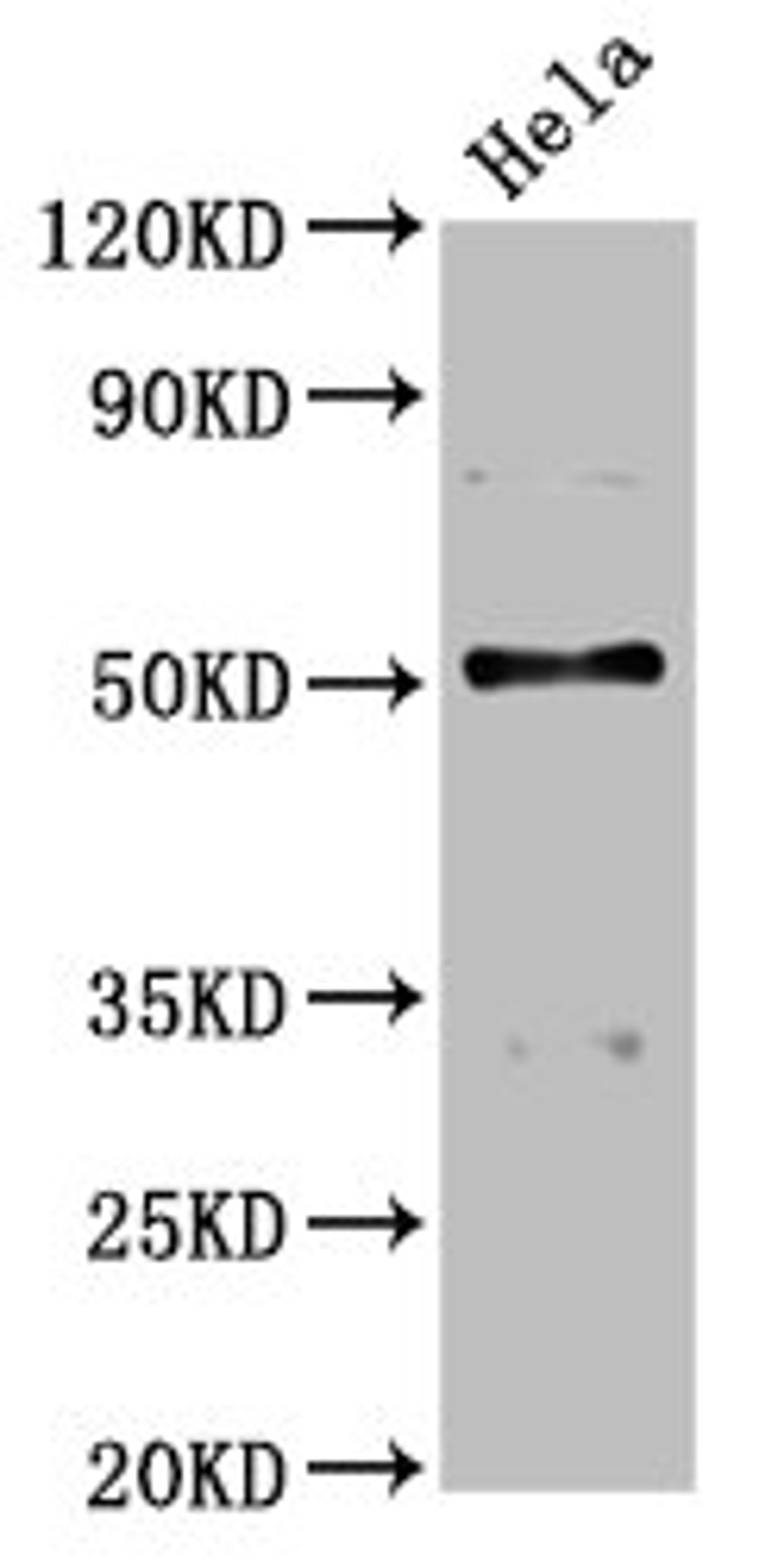 Western Blot. Positive WB detected in: Hela whole cell lysate. All lanes: BCKDHA antibody at 4.58µg/ml. Secondary. Goat polyclonal to rabbit IgG at 1/50000 dilution. Predicted band size: 51 kDa. Observed band size: 51 kDa
