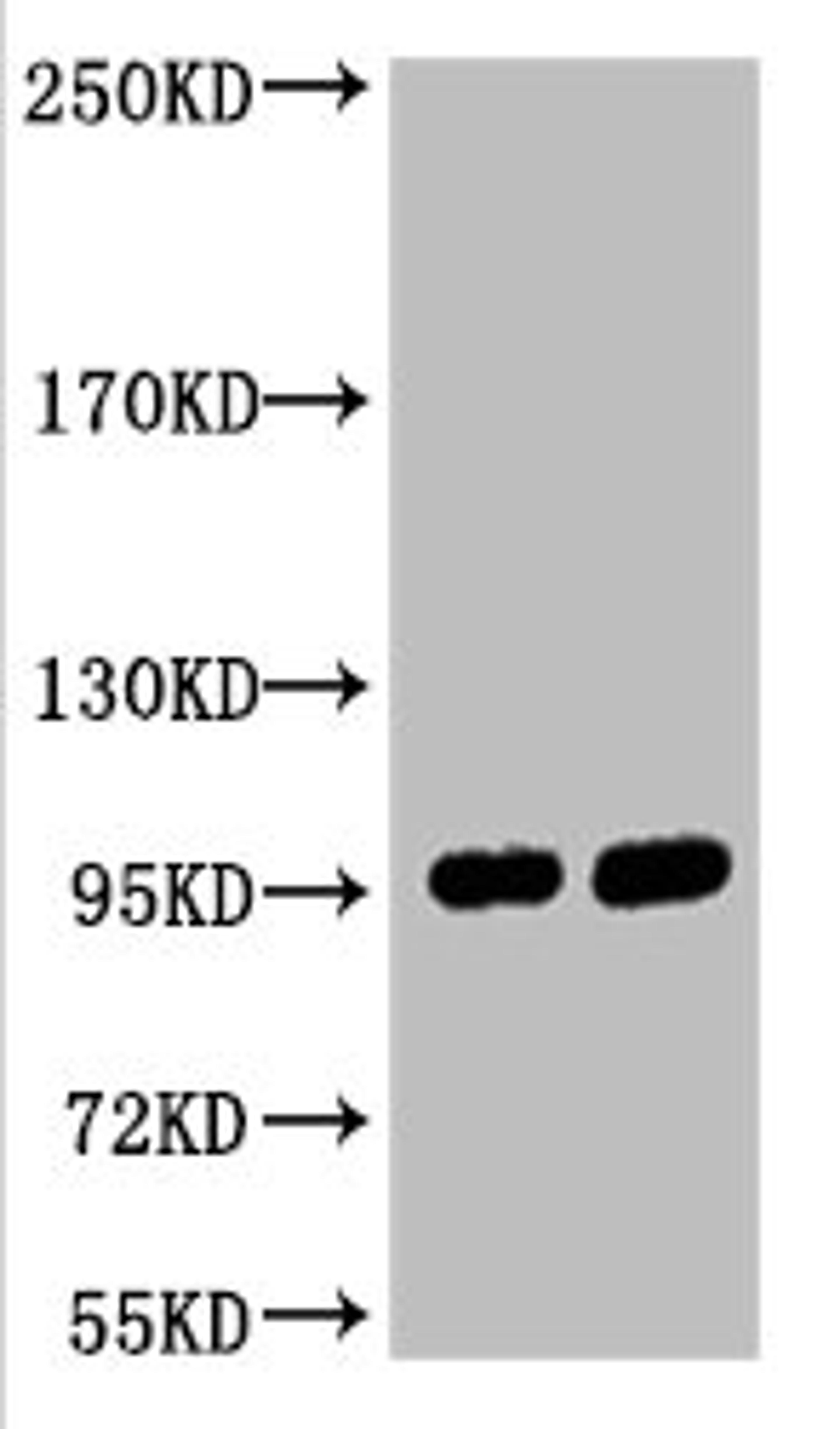 Western blot analysis of 1) Hela, 2) 293T, diluted at 1:2000.