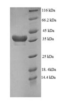 (Tris-Glycine gel) Discontinuous SDS-PAGE (reduced) with 5% enrichment gel and 15% separation gel.