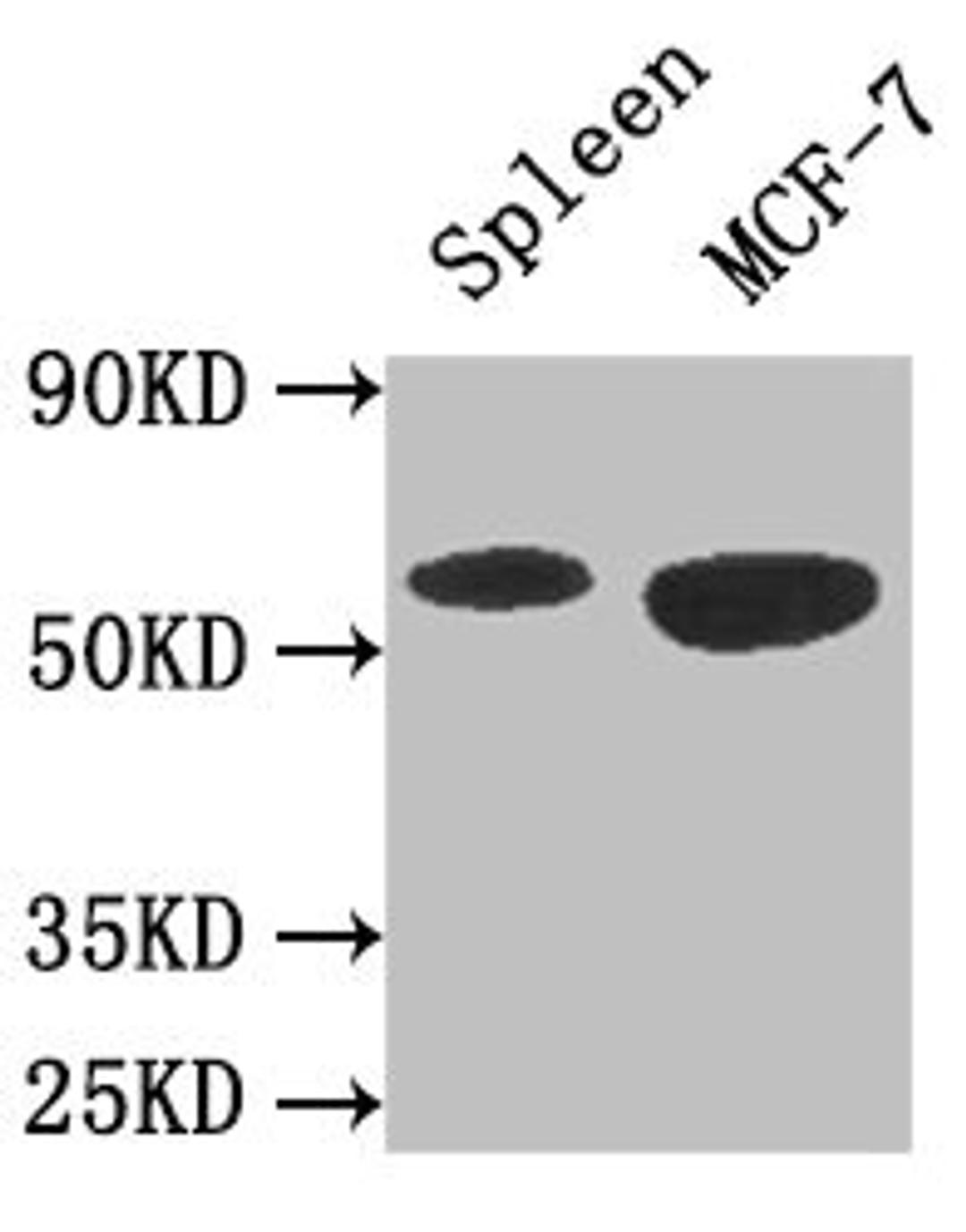 Western Blot. Positive WB detected in: Mouse spleen tissue, MCF-7 whole cell lysate. All lanes: AMPK1 antibody at 3ug/ml. Secondary. Goat polyclonal to rabbit IgG at 1/50000 dilution. Predicted band size: 65, 66 kDa. Observed band size: 65 kDa. 