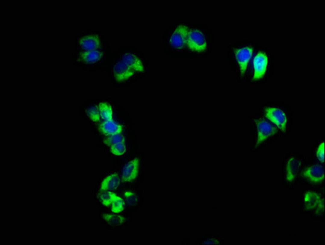 Immunofluorescence staining of PC-3 cells with CSB-PA02219A0Rb at 1:166, counter-stained with DAPI. The cells were fixed in 4% formaldehyde, permeabilized using 0.2% Triton X-100 and blocked in 10% normal Goat Serum. The cells were then incubated with the antibody overnight at 4&deg;C. The secondary antibody was Alexa Fluor 488-congugated AffiniPure Goat Anti-Rabbit IgG(H+L).