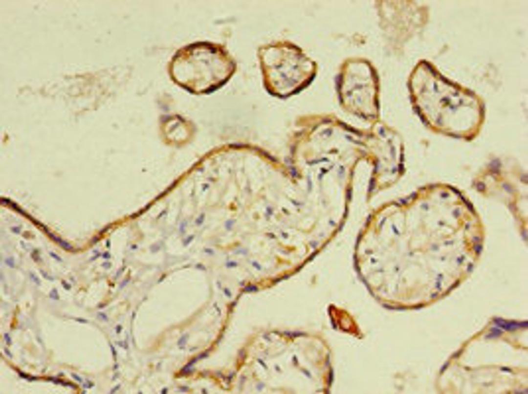 Immunohistochemistry of paraffin-embedded human placenta tissue using CSB-PA10759A0Rb at dilution of 1:100