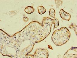 Immunohistochemistry of paraffin-embedded human placenta tissue using CSB-PA10759A0Rb at dilution of 1:100