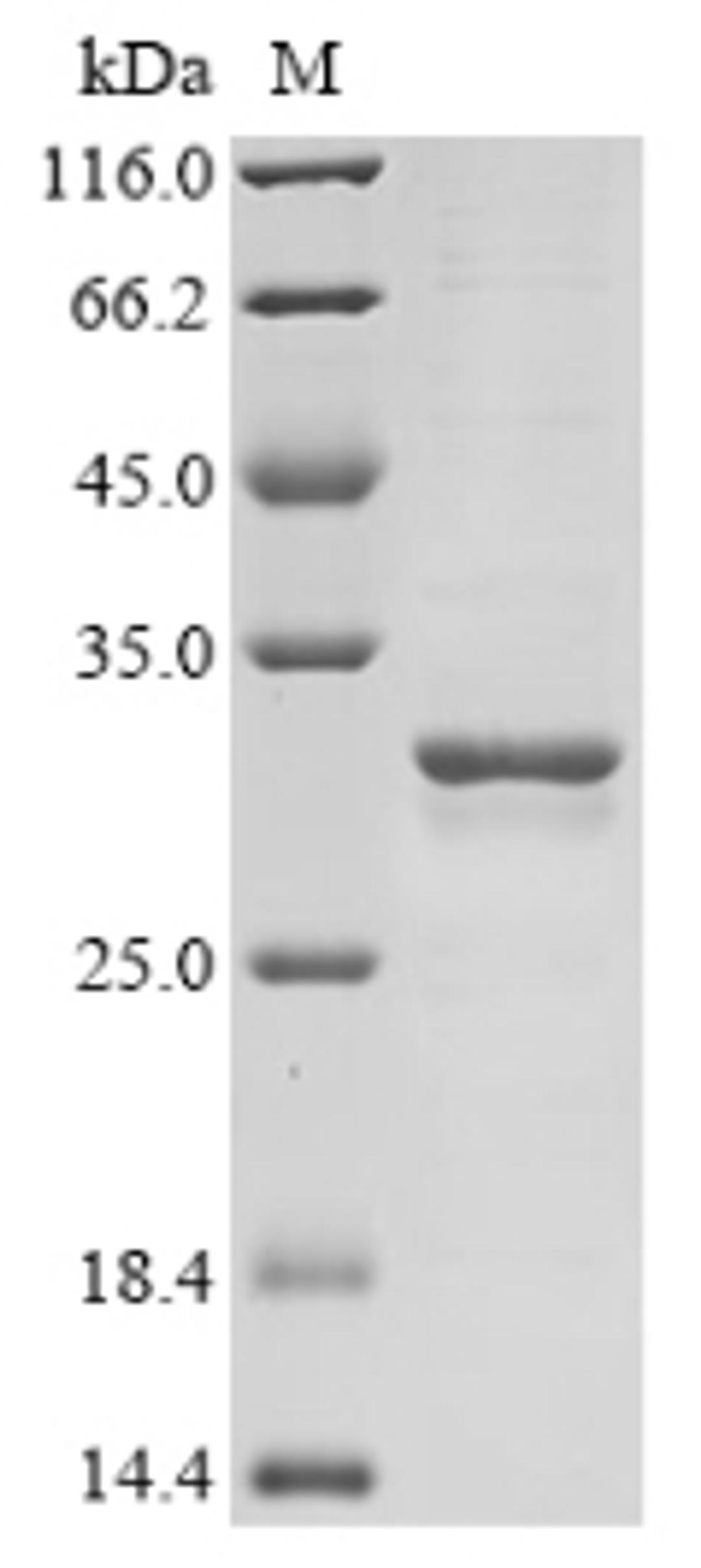 (Tris-Glycine gel) Discontinuous SDS-PAGE (reduced) with 5% enrichment gel and 15% separation gel.