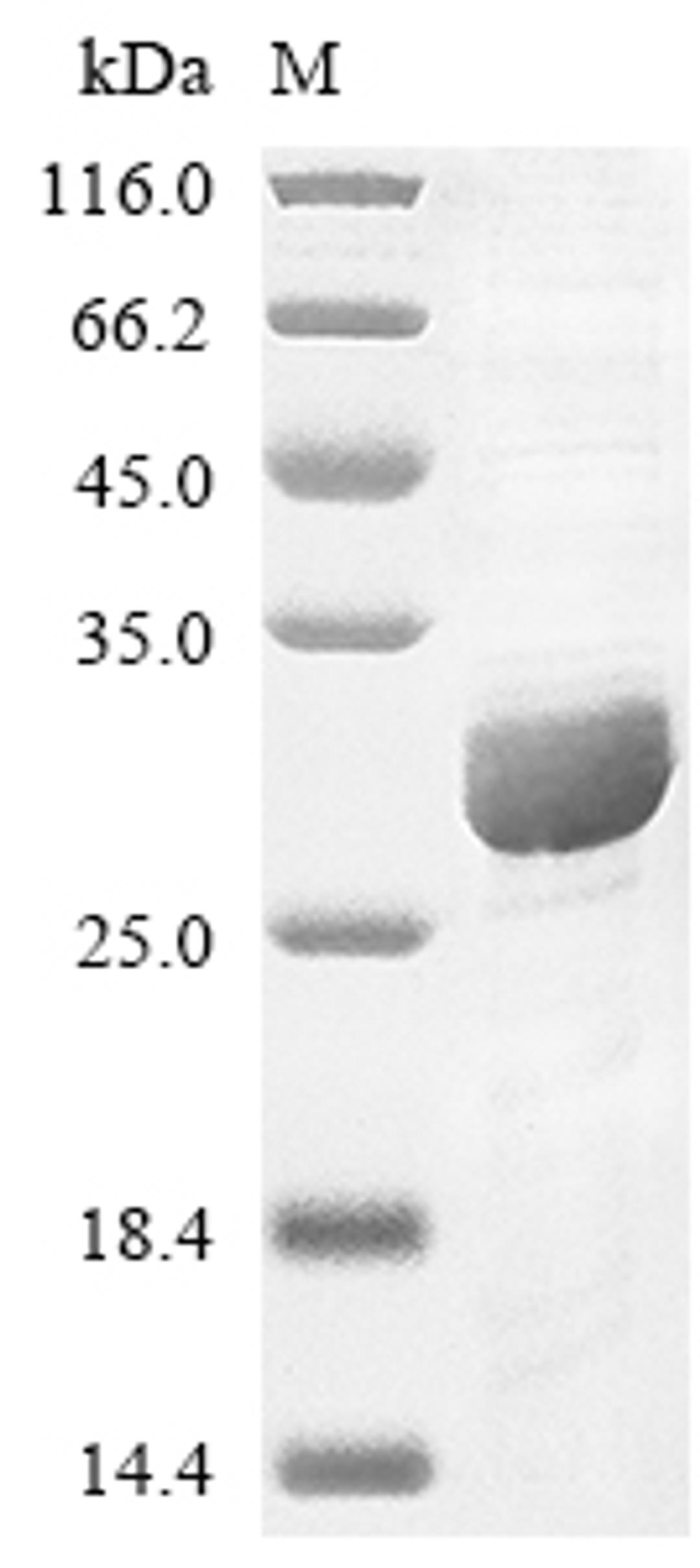 (Tris-Glycine gel) Discontinuous SDS-PAGE (reduced) with 5% enrichment gel and 15% separation gel.